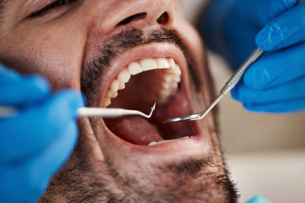 Best Oral Cancer Screening  in Bethesda, MD